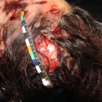 Brutally raped pregnant Chinese woman in morgue