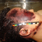 Brutally raped pregnant Chinese woman in morgue