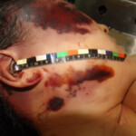 Brutally raped pregnant Chinese woman in morgue