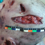 Brutally raped pregnant Chinese woman in morgue