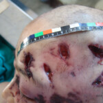 Brutally raped pregnant Chinese woman in morgue