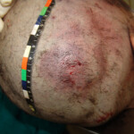 Brutally raped pregnant Chinese woman in morgue