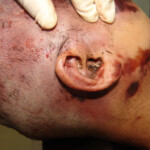 Brutally raped pregnant Chinese woman in morgue