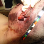 Brutally raped pregnant Chinese woman in morgue