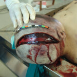 Brutally raped pregnant Chinese woman in morgue