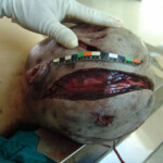 Brutally raped pregnant Chinese woman in morgue