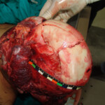 Brutally raped pregnant Chinese woman in morgue