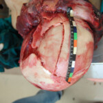 Brutally raped pregnant Chinese woman in morgue