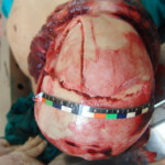 Brutally raped pregnant Chinese woman in morgue