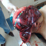 Brutally raped pregnant Chinese woman in morgue