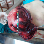 Brutally raped pregnant Chinese woman in morgue