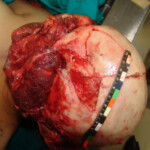 Brutally raped pregnant Chinese woman in morgue