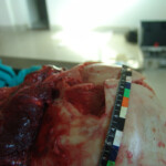 Brutally raped pregnant Chinese woman in morgue