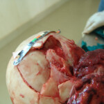 Brutally raped pregnant Chinese woman in morgue