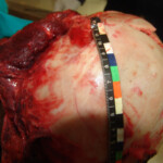 Brutally raped pregnant Chinese woman in morgue