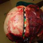 Brutally raped pregnant Chinese woman in morgue