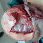 Brutally raped pregnant Chinese woman in morgue