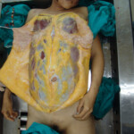 Brutally raped pregnant Chinese woman in morgue