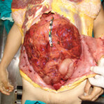 Brutally raped pregnant Chinese woman in morgue