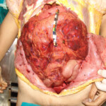 Brutally raped pregnant Chinese woman in morgue