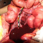 Brutally raped pregnant Chinese woman in morgue