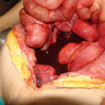 Brutally raped pregnant Chinese woman in morgue