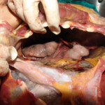 Brutally raped pregnant Chinese woman in morgue