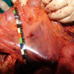 Brutally raped pregnant Chinese woman in morgue