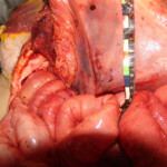 Brutally raped pregnant Chinese woman in morgue