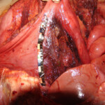 Brutally raped pregnant Chinese woman in morgue