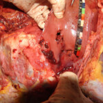 Brutally raped pregnant Chinese woman in morgue