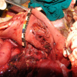 Brutally raped pregnant Chinese woman in morgue