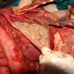 Brutally raped pregnant Chinese woman in morgue