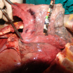 Brutally raped pregnant Chinese woman in morgue