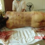 Brutally raped pregnant Chinese woman in morgue
