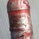 Demostrant hit by tear grenade to the head