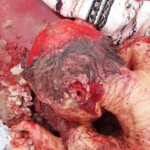 Elderly woman killed by bear