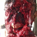 Face torn by himalayan black bear