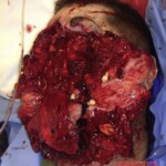 Guy survived suicide attempt