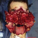 Guy survived suicide attempt