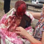 Face eaten by pitbulls