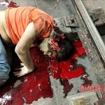 Brain ejected suicide