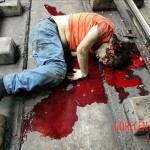 Brain ejected suicide