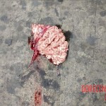 Brain ejected suicide