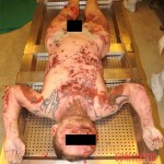 Suicide by skydiving