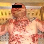 Suicide by skydiving