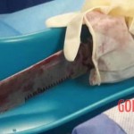 Man stabbed in eye with dagger