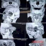 Man stabbed in eye with dagger