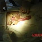 Necrosis of testicles