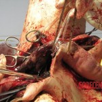 Necrosis of testicles